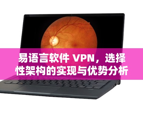 易语言软件 VPN，选择性架构的实现与优势分析